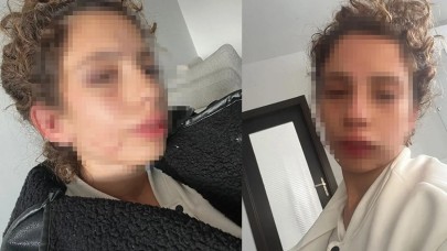 Ayrılmak isteyen sevgilisini saatlerce dövmüştü: İstenen ceza belli oldu
